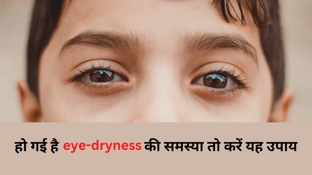 eye dryness home remedies