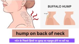 hump on back of neck in hindi