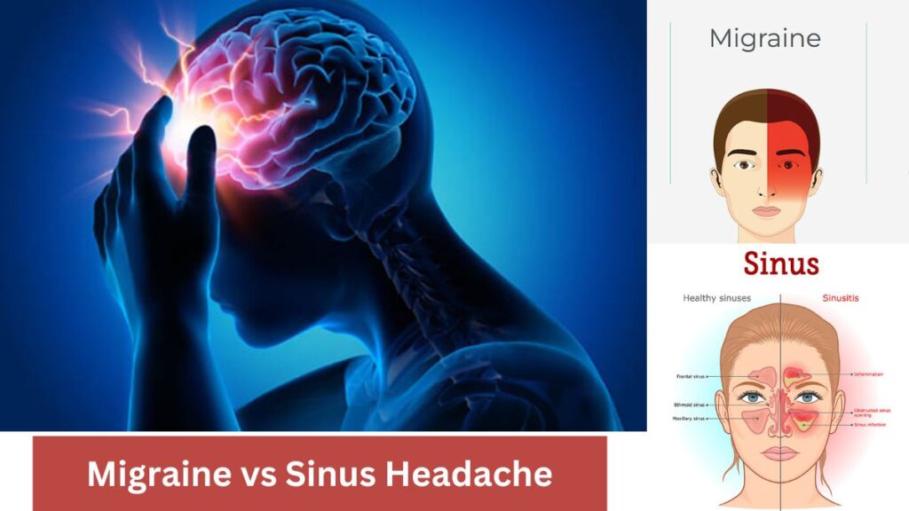 Sinus vs migraine