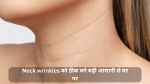 Neck wrinkles